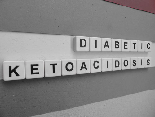 Understanding Pediatric Diabetic Ketoacidosis: Key Facts