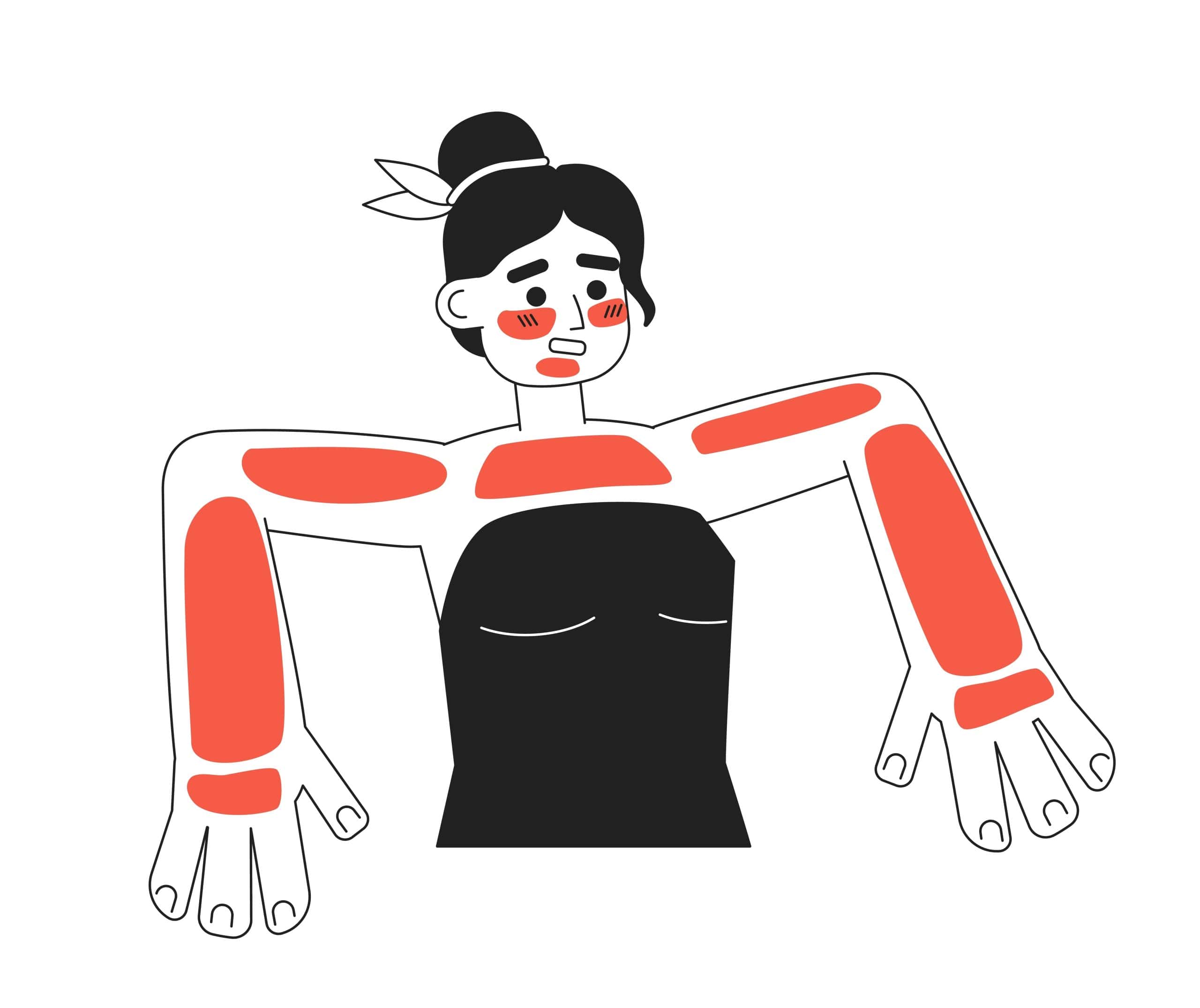 Sunburn VS Sun Poisoning? Differences and Prevention Tips